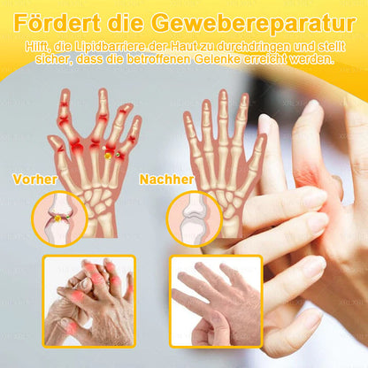 XRLXRL® Bienengift Schmerzstillende Knochenheilungscreme 👨‍⚕️👨‍⚕️LETZTER TAG 80 % RABATT