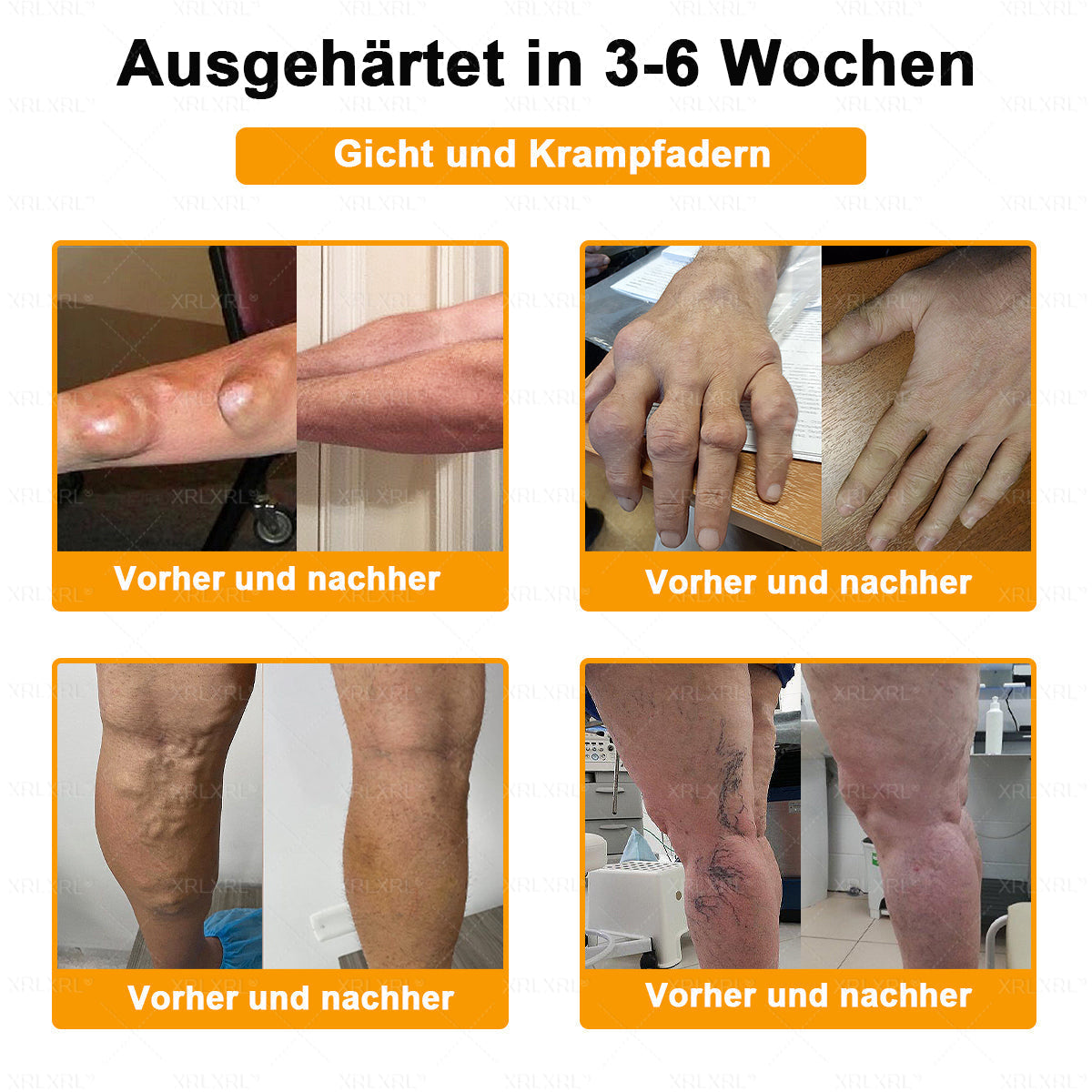 XRLXRL® Bienengift Schmerzstillende Knochenheilungscreme 👨‍⚕️👨‍⚕️LETZTER TAG 80 % RABATT
