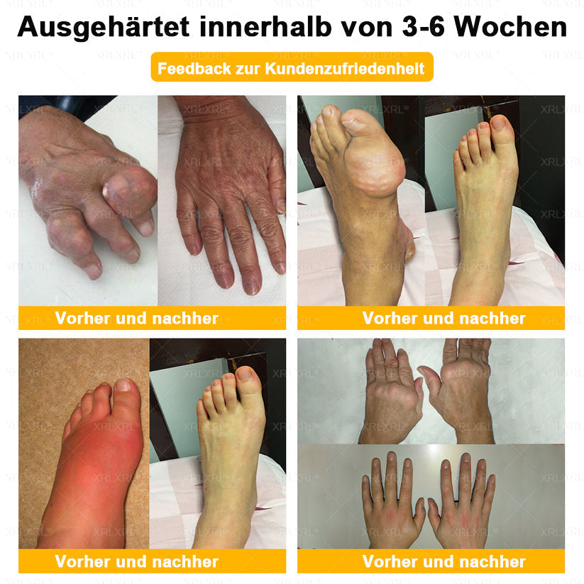 XRLXRL® Bienengift Schmerzstillende Knochenheilungscreme 👨‍⚕️👨‍⚕️LETZTER TAG 80 % RABATT