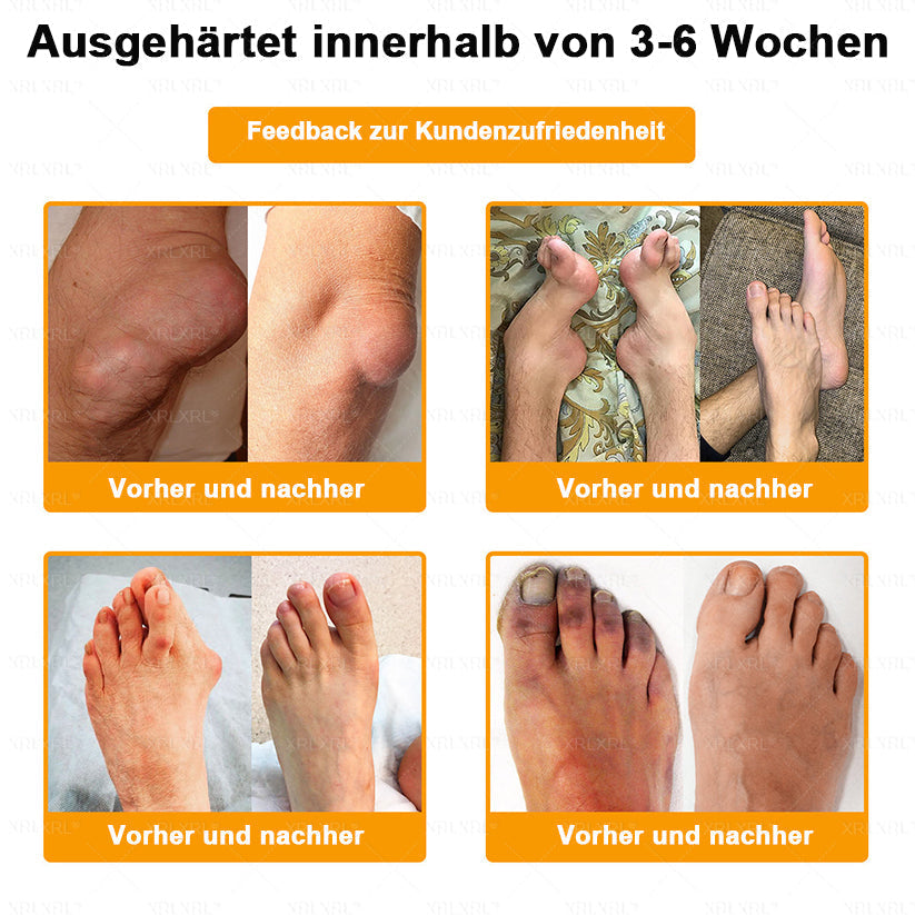 XRLXRL® Bienengift Schmerzstillende Knochenheilungscreme 👨‍⚕️👨‍⚕️LETZTER TAG 80 % RABATT