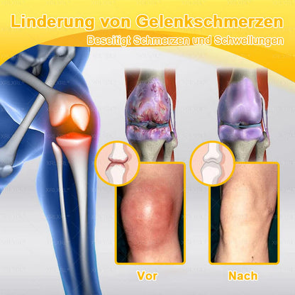 XRLXRL® Bienengift Schmerzstillende Knochenheilungscreme 👨‍⚕️👨‍⚕️LETZTER TAG 80 % RABATT