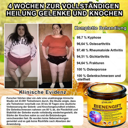 XRLXRL® Bienengift Schmerzstillende Knochenheilungscreme 👨‍⚕️👨‍⚕️LETZTER TAG 80 % RABATT